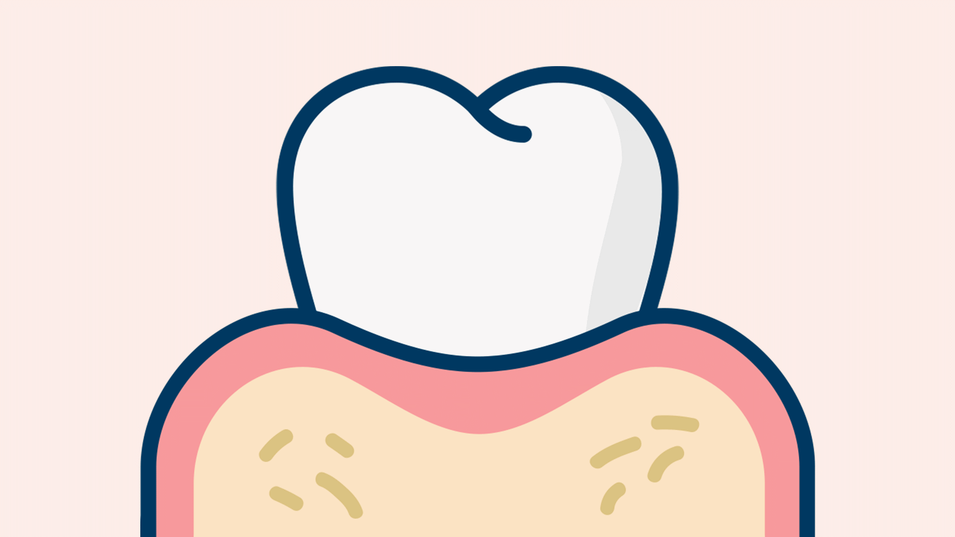 임플란트 한 지 몇 년 됐는데, 최근에 음식 씹을 때 이상한 경우