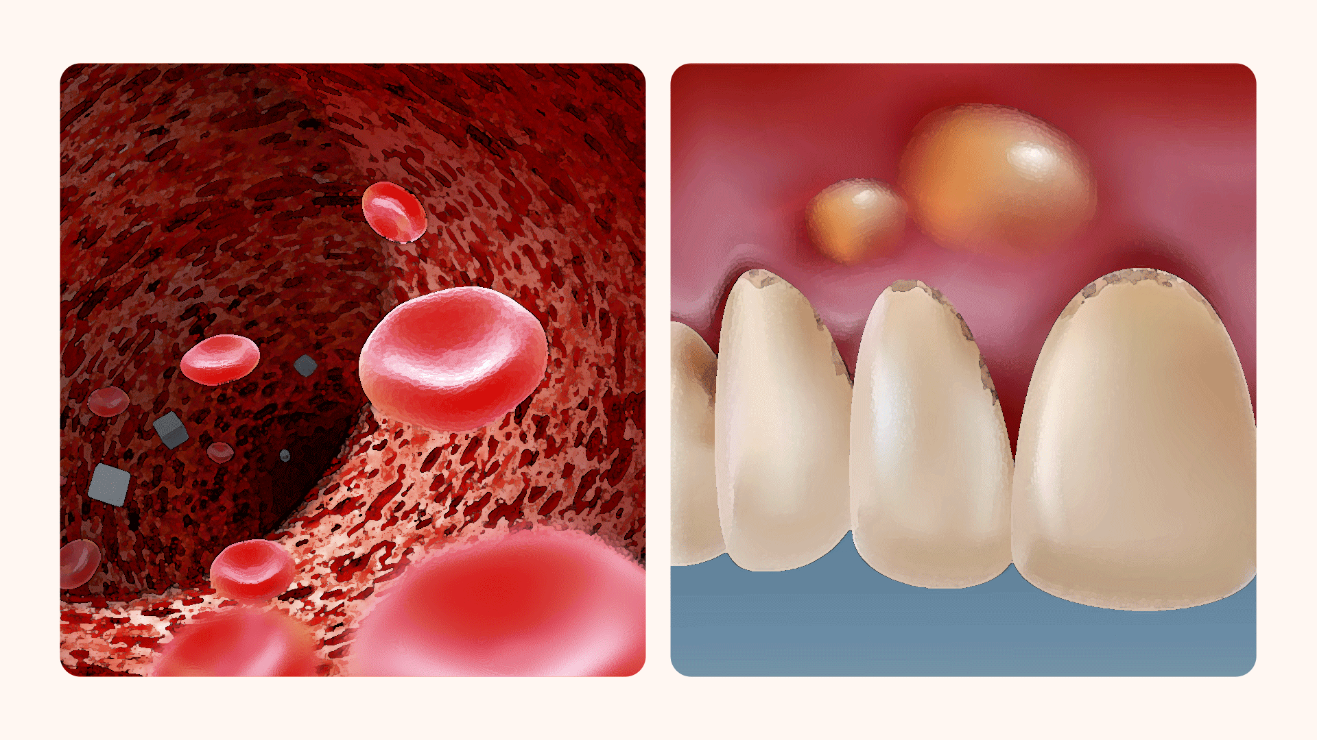 An image visually representing slower recovery after dental implant surgery for diabetic patients