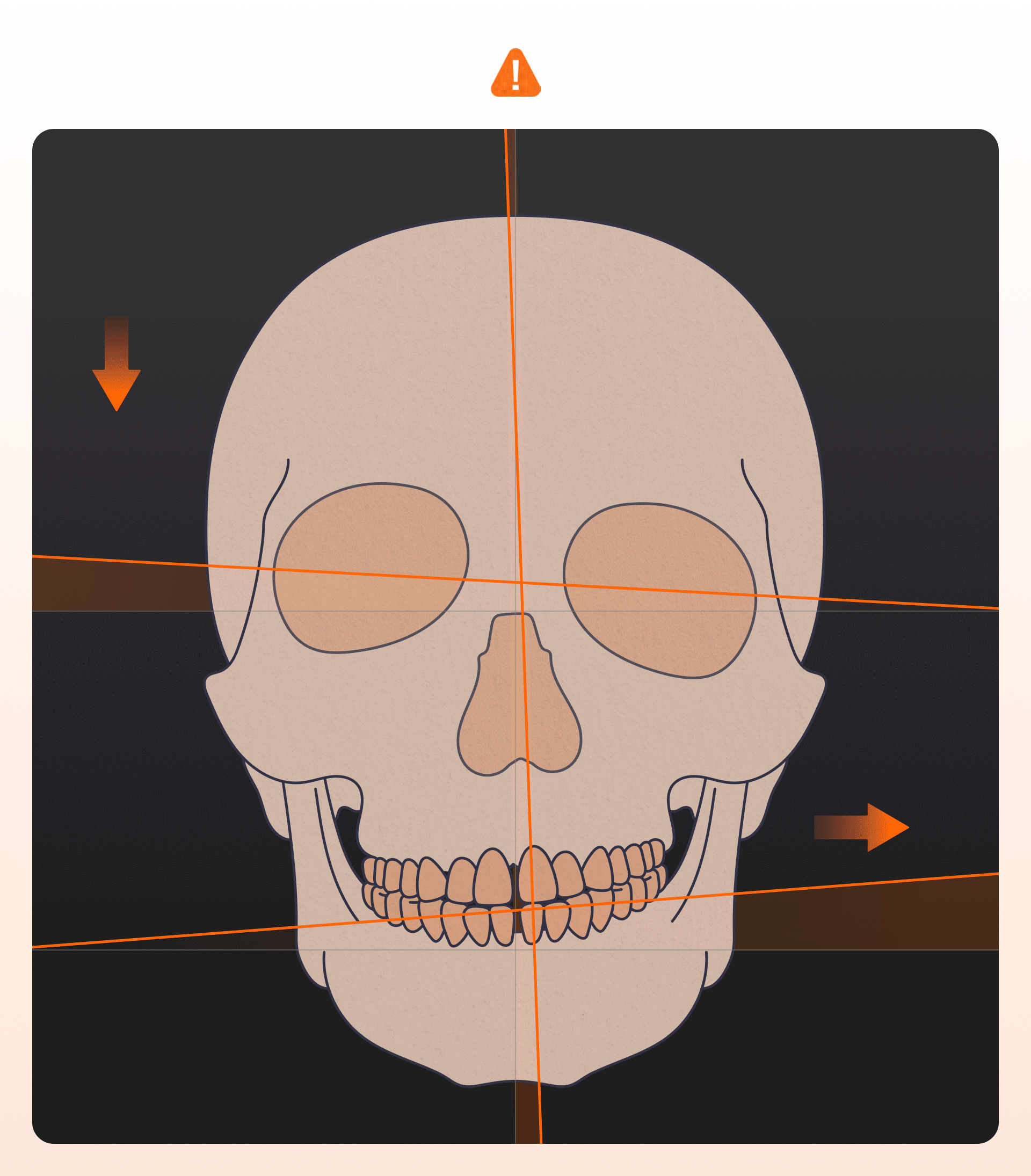 턱이 한쪽으로 치우치거나 얼굴이 비뚤어져 보일 때의 골구조