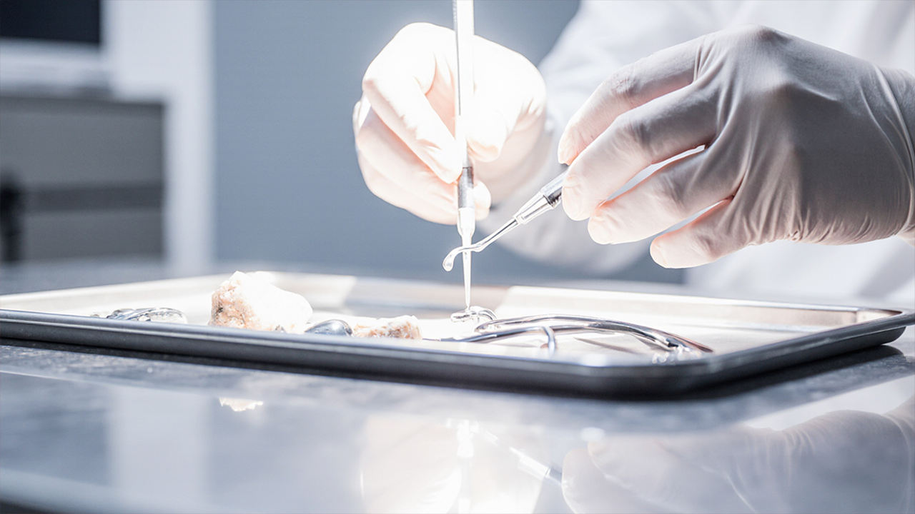 임플란트 재수술 신호 4가지 | 성공률을 높이는 골든타임