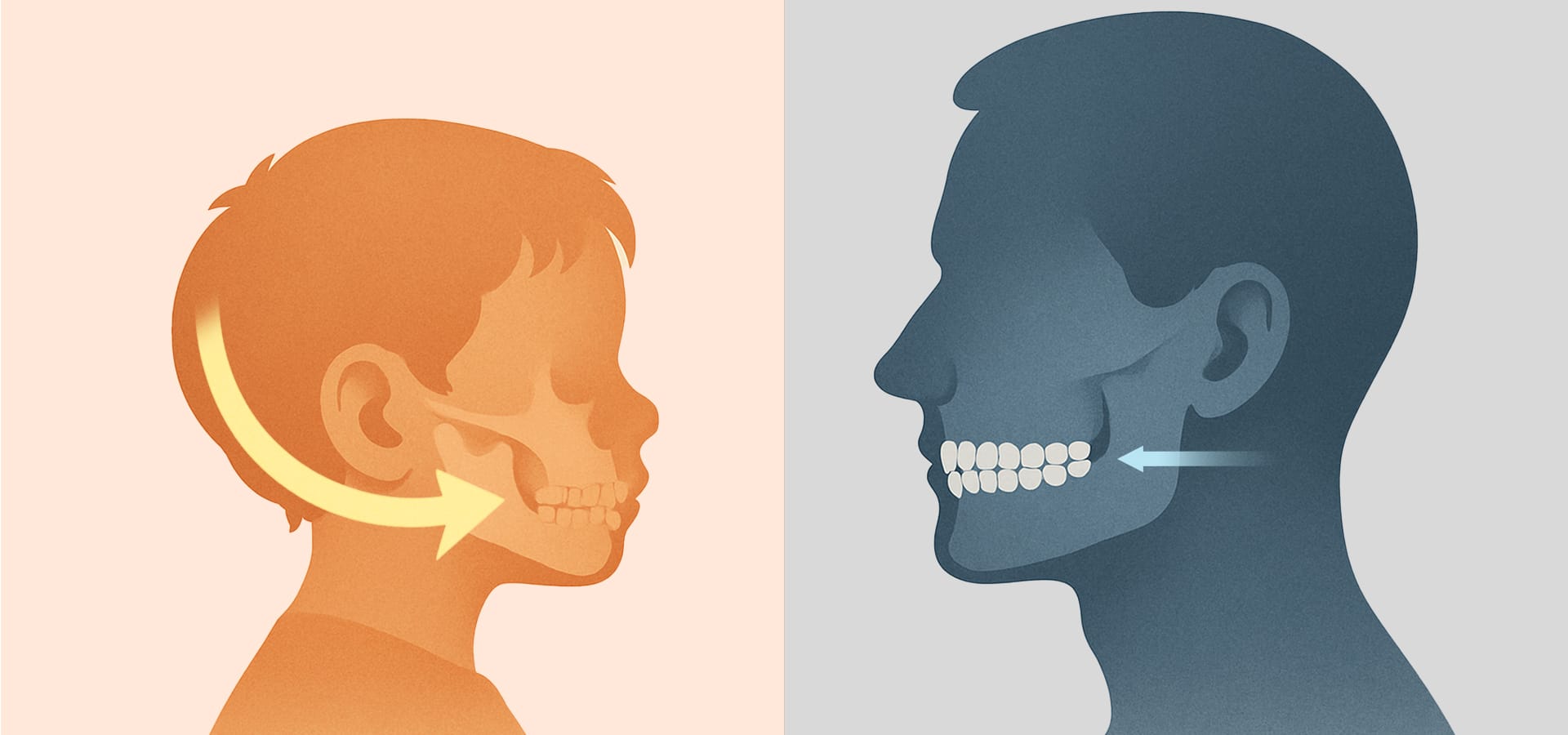 성장기 교정은 턱뼈 성장을 활용하여 폭넓은 변화가 가능하고(두껍고 넓은 곡선), 성인 교정은 치아에 집중하여 세밀한 변화만 가능한(얇고 짧은 직선) 조절 범위의 차이를 표현한 그래픽