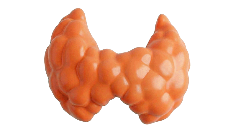 건강한 핑크빛 나비 모양의 갑상선 위에 작고 매끄러운 구슬 하나가 살짝 얹혀 있는 모습 