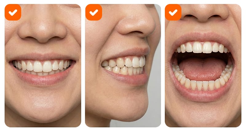 Illustration of a standardized guide for taking frontal, profile, and smile photos for a dental consultation.