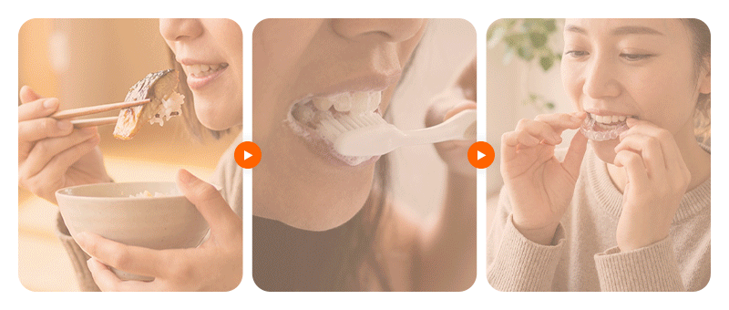 A split-screen image comparing the dental visit schedules and frequency for clear aligners versus fixed brackets.