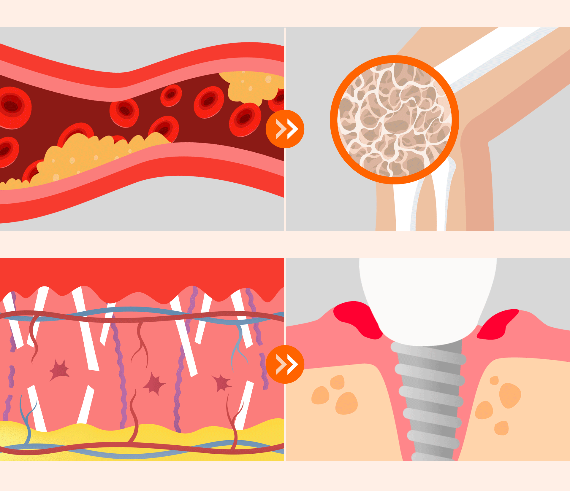 An image expressing how unstable blood sugar affects wounds and infection