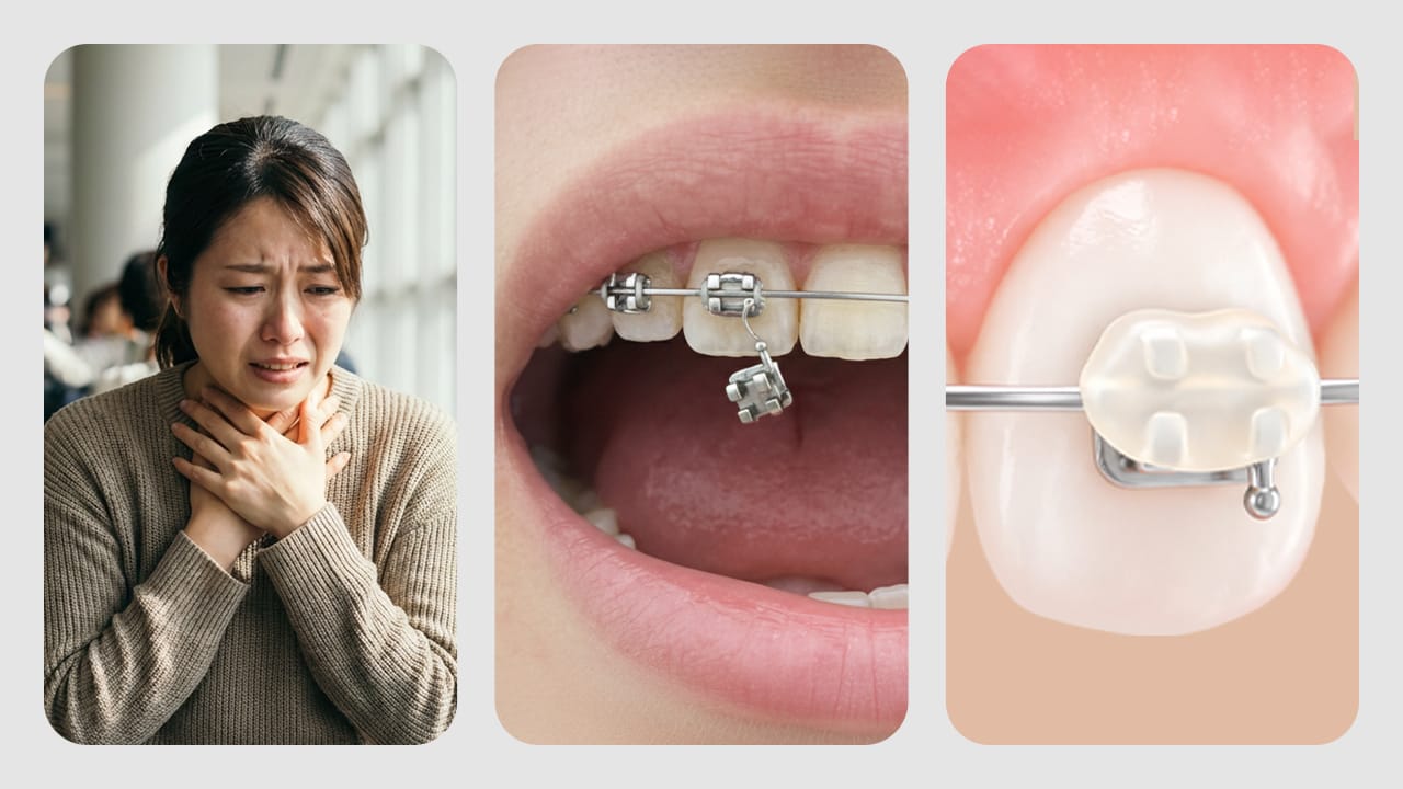 海外で矯正装置にトラブルが発生した時：信号機分類法で対処する