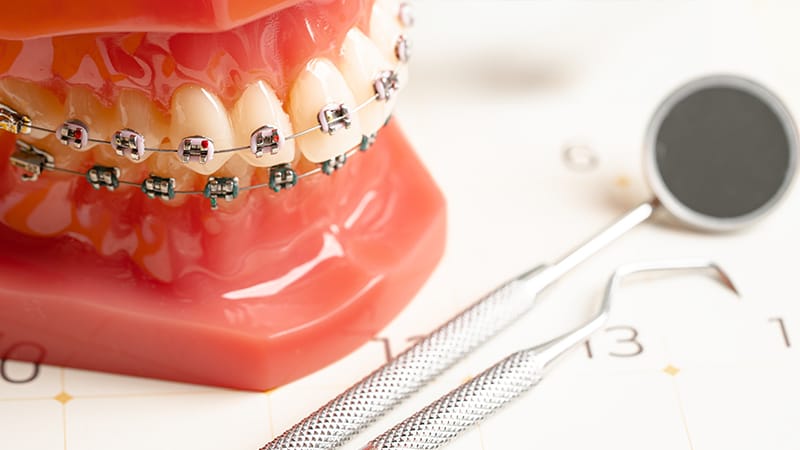 12,18,and 24-Month Orthodontic Visit Plans and Checkpoints by Stay Duration