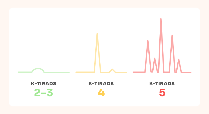 Visualization of increasing risk levels and malignancy suspicion according to K-TIRADS grades.