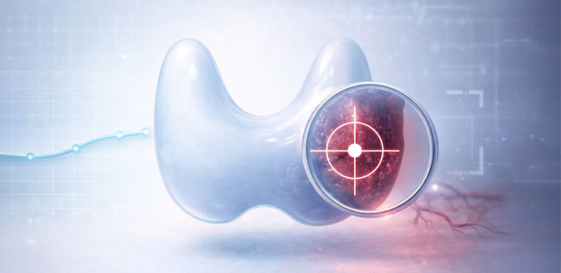 A visualization of thyroid cancer that may seem mild externally but is being strictly managed through professional medical monitoring.