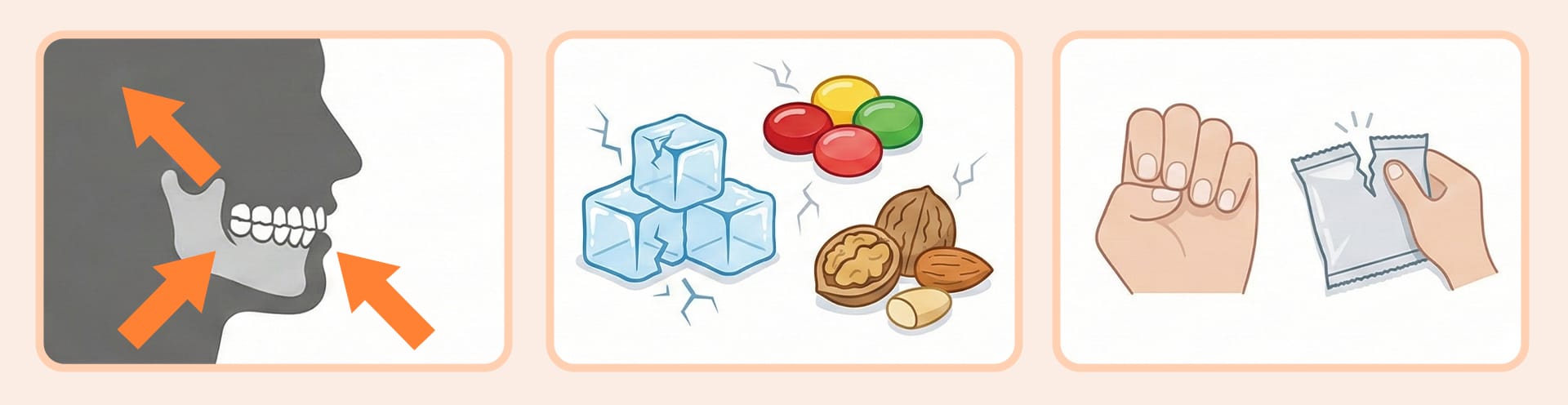 라미네이트 파절을 유발하는 이갈이, 딱딱한 음식, 손톱 물어뜯기 등의 악습관 아이콘.