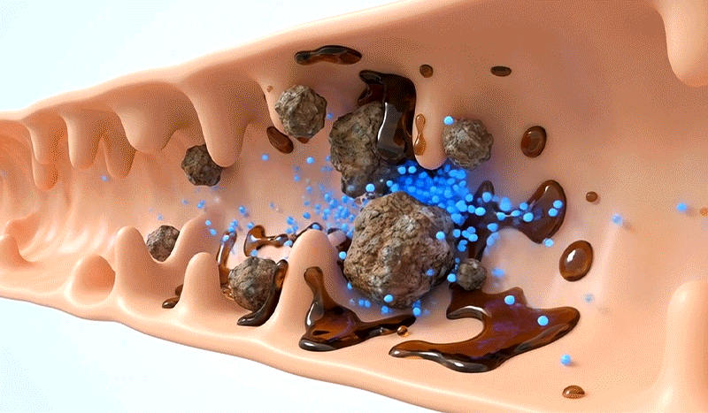 Obstacles in the digestive tract blocking thyroid medication absorption, illustrating the 4-hour rule.