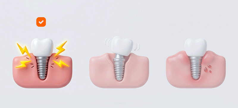 An infographic illustrating a 3-point checklist for dental implants, including pain, looseness, and bleeding.