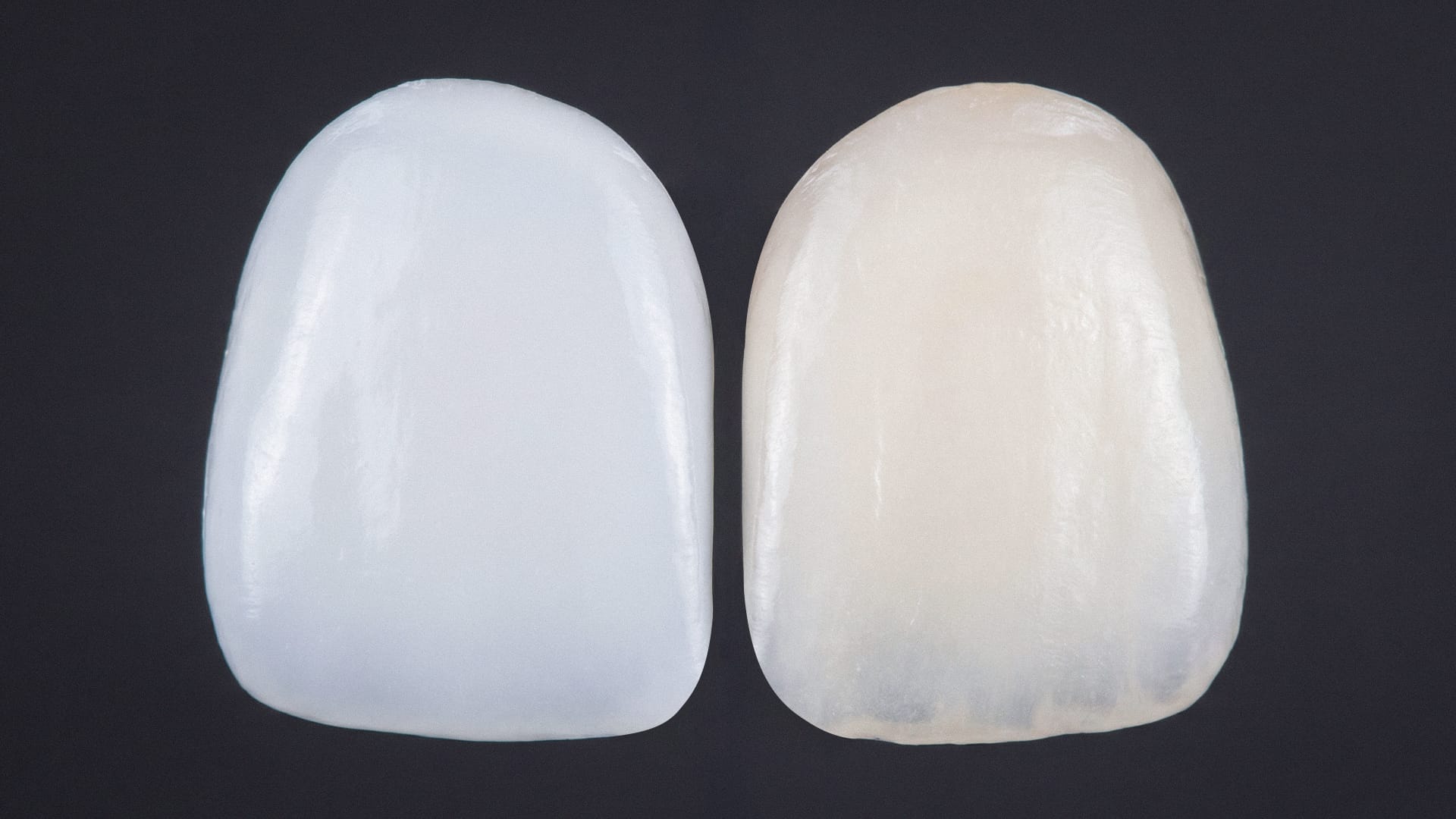 Before and after comparison of natural teeth and cosmetic dental veneers.