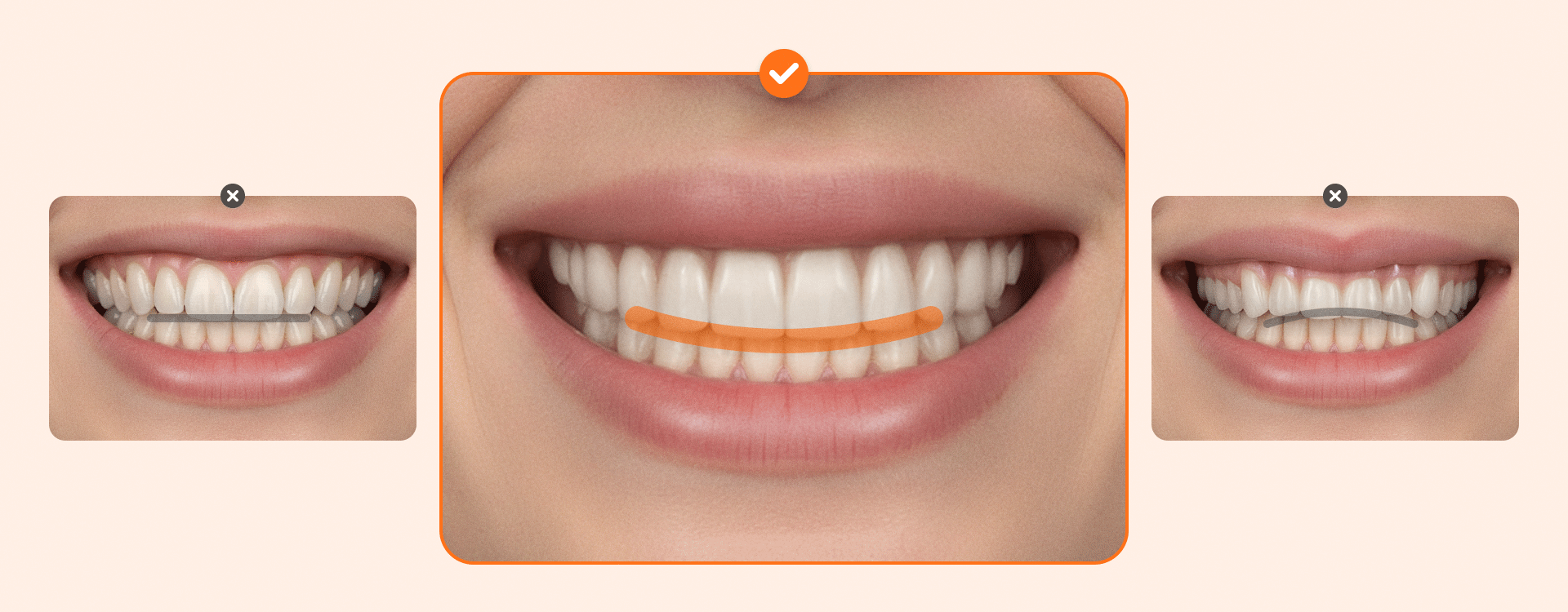Geometric representation of an ideal smile arc in cosmetic dental design.