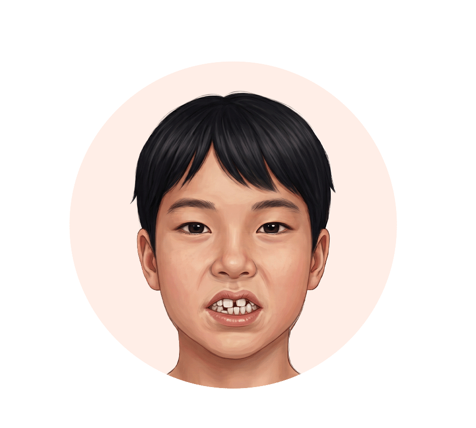 교정 중인 치아 GIF 일러스트