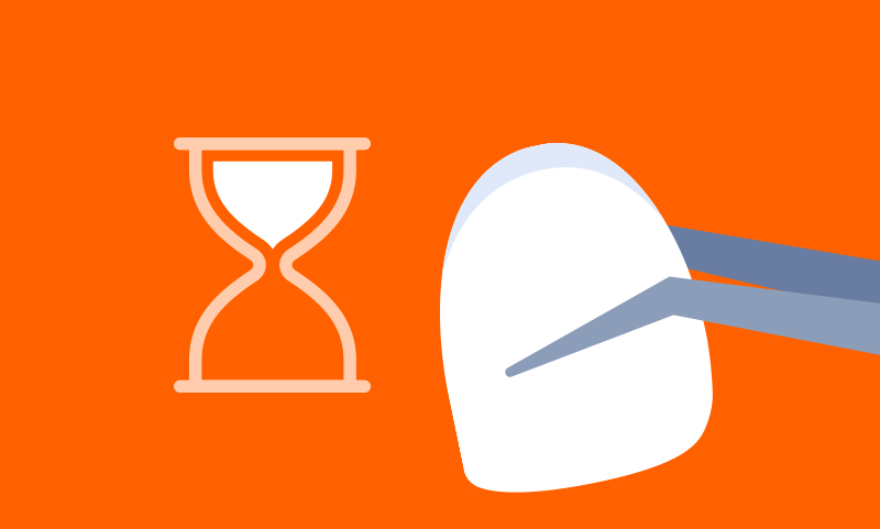 An illustration of a dental veneer next to an hourglass, symbolizing veneer lifespan and replacement timing