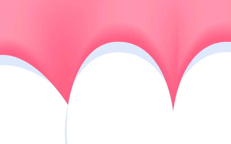 A diagram showing a micro-gap forming in the adhesive bonding layer beneath a dental veneer over time
