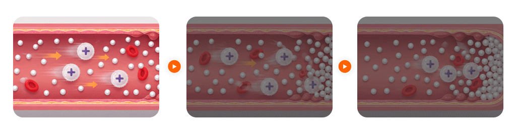 A medical illustration showing high glucose levels in blood vessels hindering the movement of immune cells