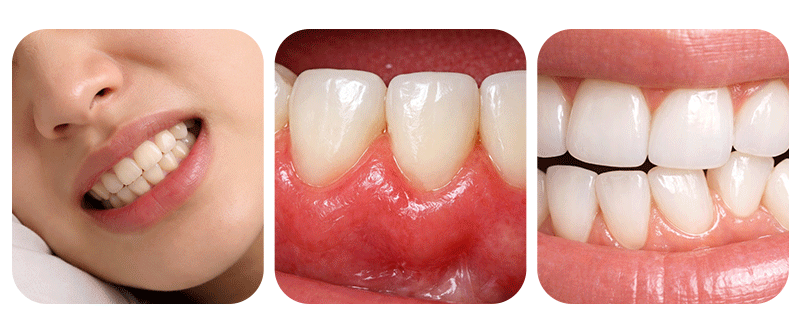 An image illustrating clinical pre-treatment diagnostic criteria and oral screening