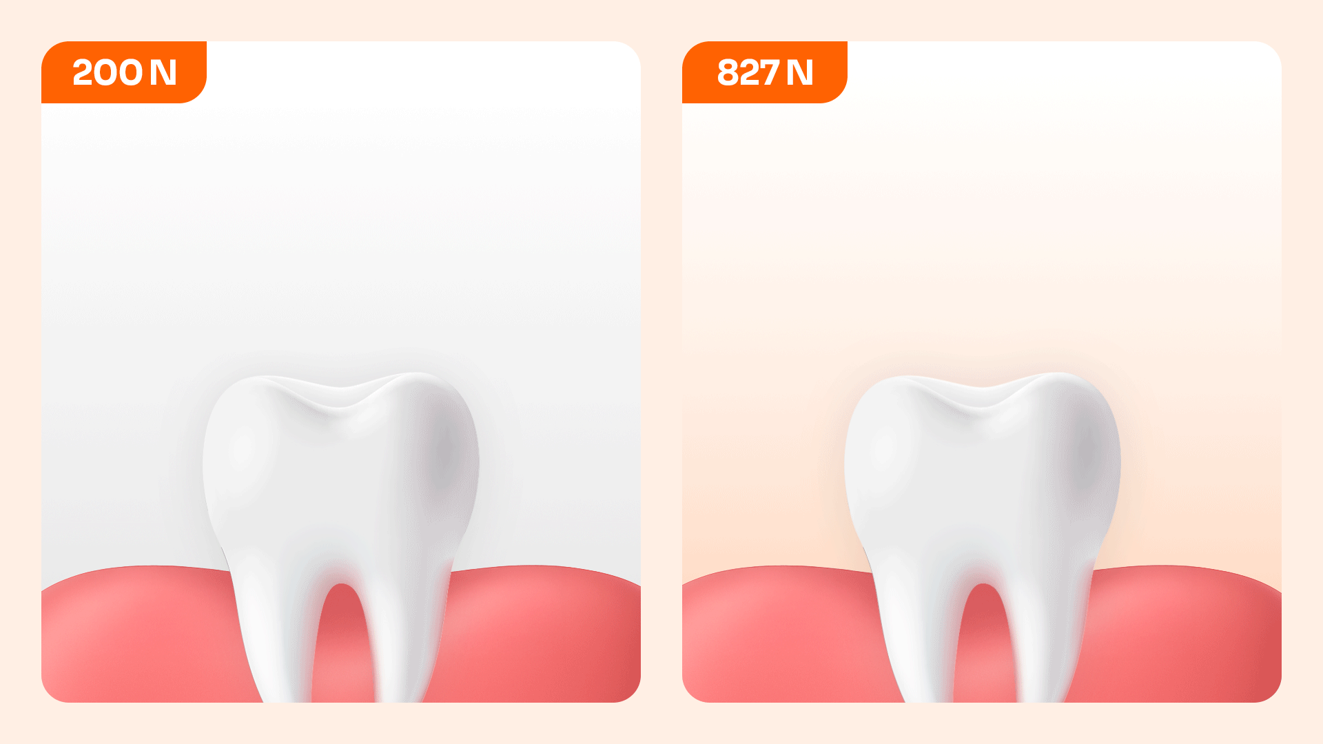 An infographic comparing bite force during sleep bruxism (827 N) to normal chewing force (200 N) to show tooth damage risks