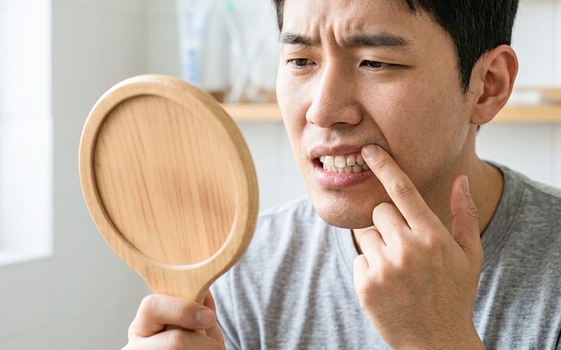 치면탈회가 된 치아를 거울로 보며 걱정하고 있는 2030