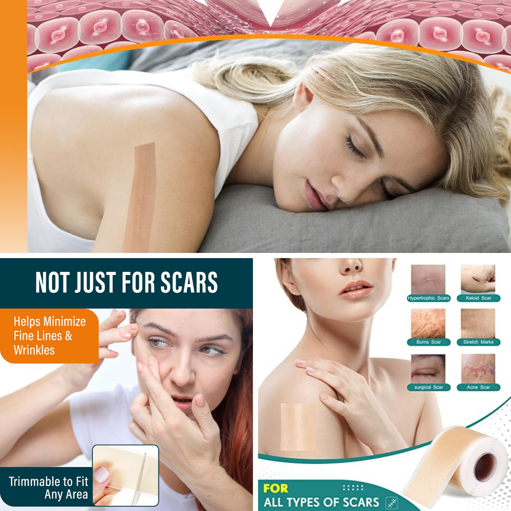Silicone Scar Tape