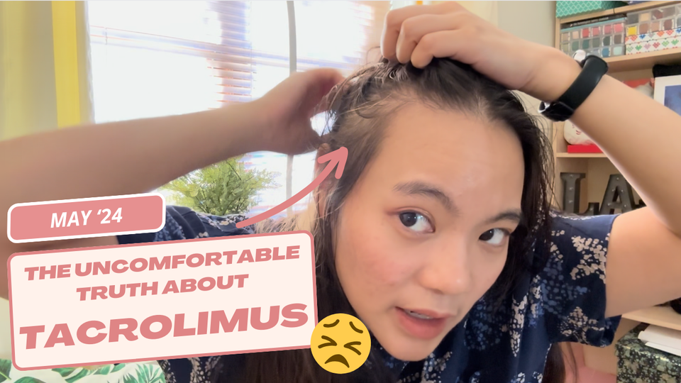 Hair Loss Post Kidney Transplant - Adoport Tacrolimus