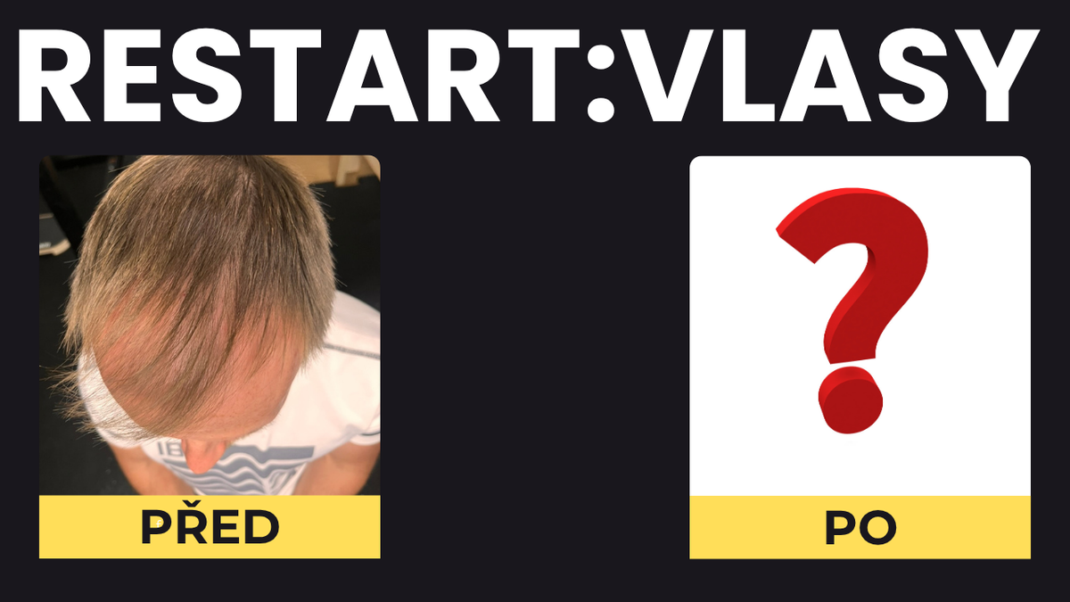 Projekt RESTART: VLASY – Start👨‍🦲
