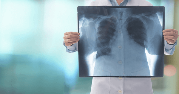 XVision, the first Romanian AI app for radiologists, grabs €1M to expand in Western Europe and enter the US