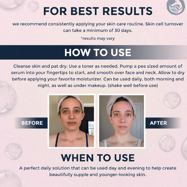 Consistency for Best Results