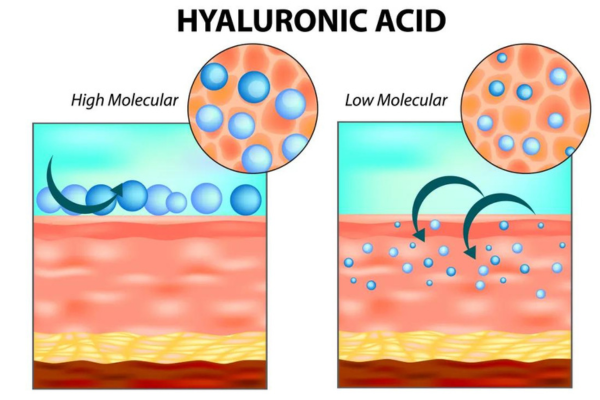Source: Cosmoderma
