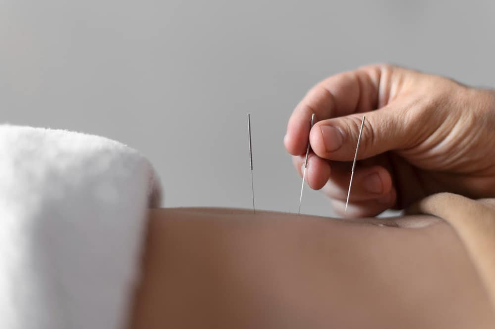 Close-up hand holding acupuncture needle
