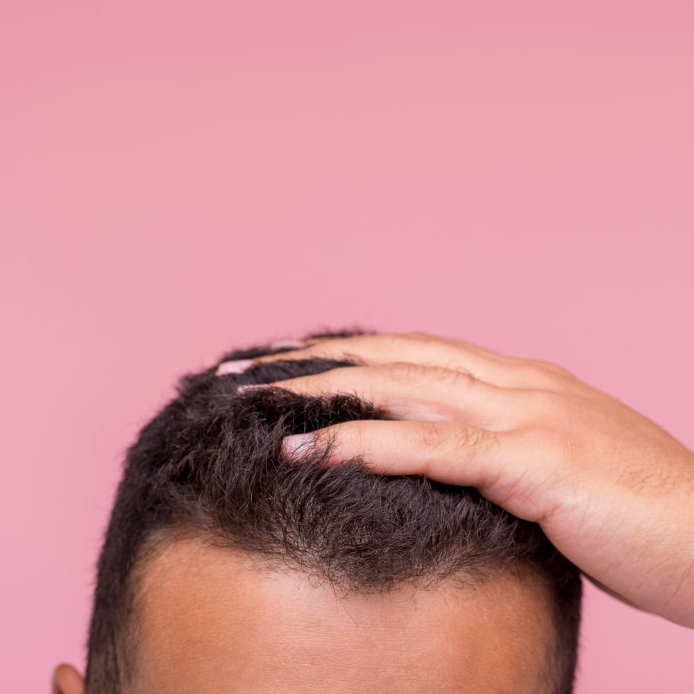 Did you know that almost 50 percent of women and around 80 percent of men struggle with hair loss
