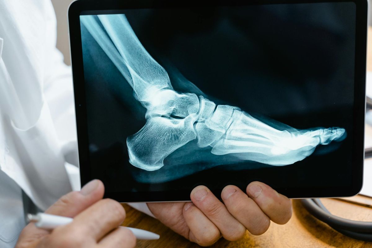 What Are the Biggest Myths About Personal Injury Claims That Victims Should Know