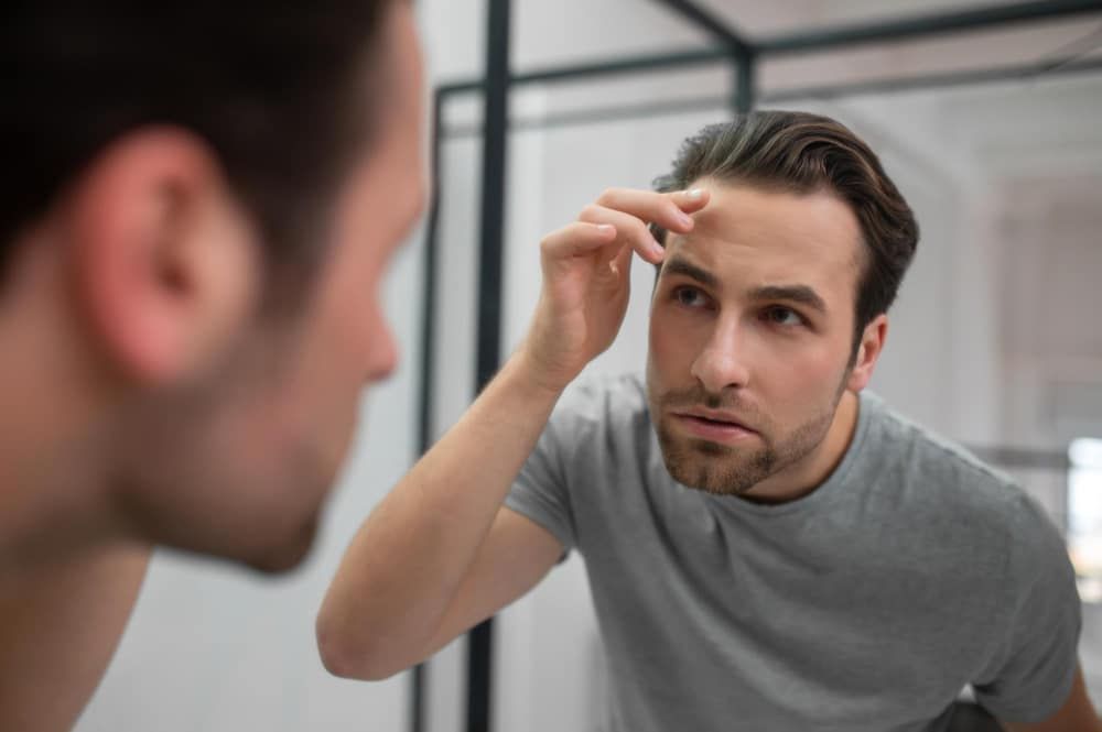 Best Acne Scar Treatments (Updated)