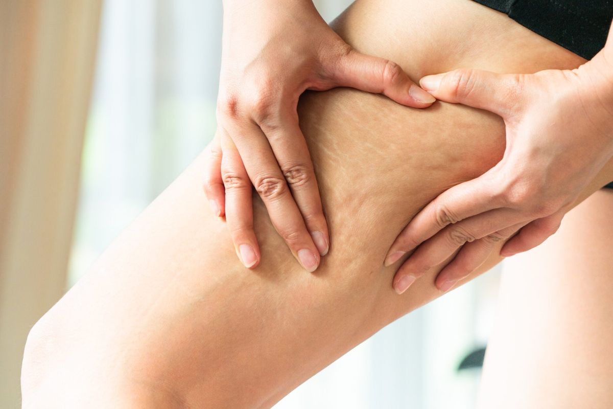 Understanding Weight Loss Medications: What You Need to Know Before You Start