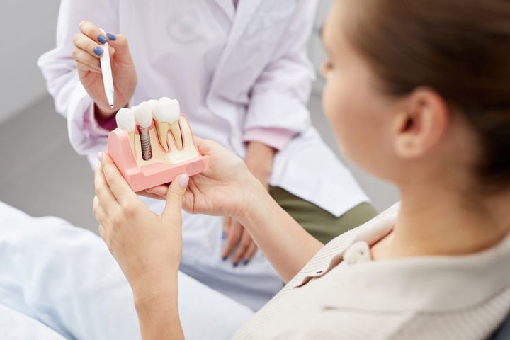When Do You Need A Dental Implant? 7 Key Signs