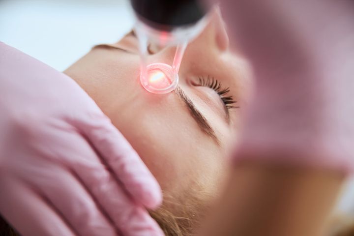 What is CO2 Laser Skin Treatment?