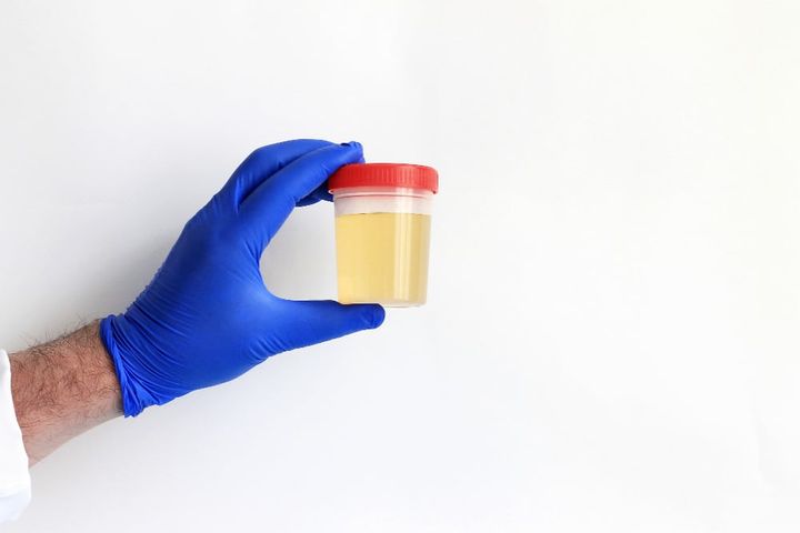 Doctor's hand in glove holding urine specimen: medical analysis, urine analysis.