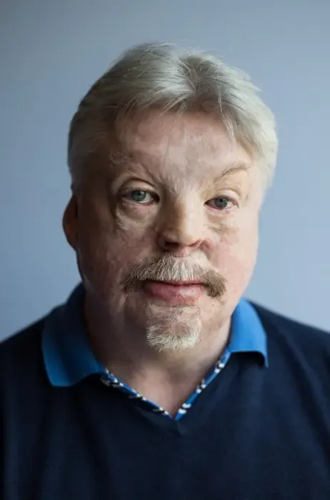 simon weston