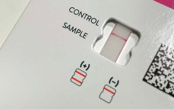 Indignity Vol. 2, No. 34: The smell of success.