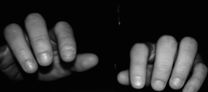 A black-and-white photograph of someone’s hands (mine).