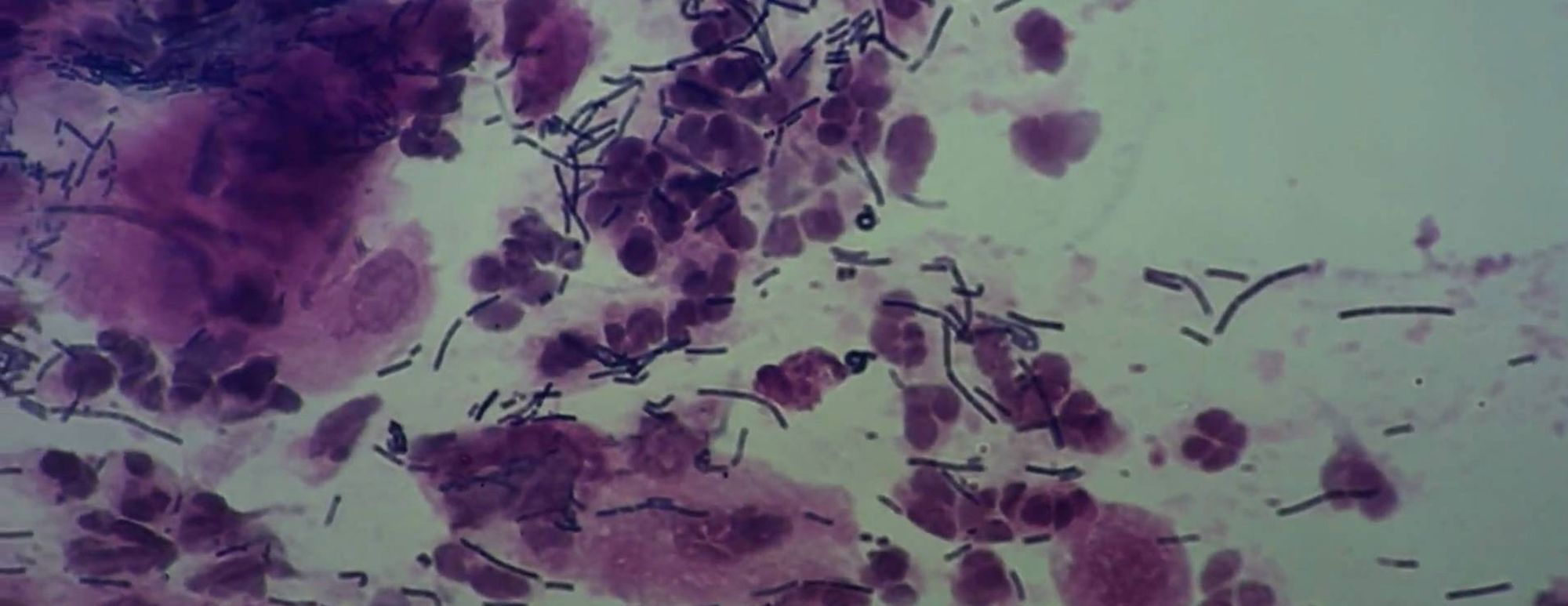 Live Food Logic (Part 2)