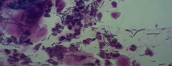 Live Food Logic (Part 2)