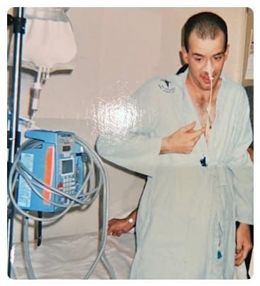 A balding white man in his 20s in blue hosptial gown stands in front of a hospital bed.  A white tube dangles from his nose.