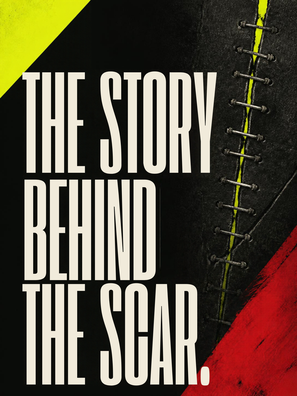 THE STORY BEHIND THE SCAR