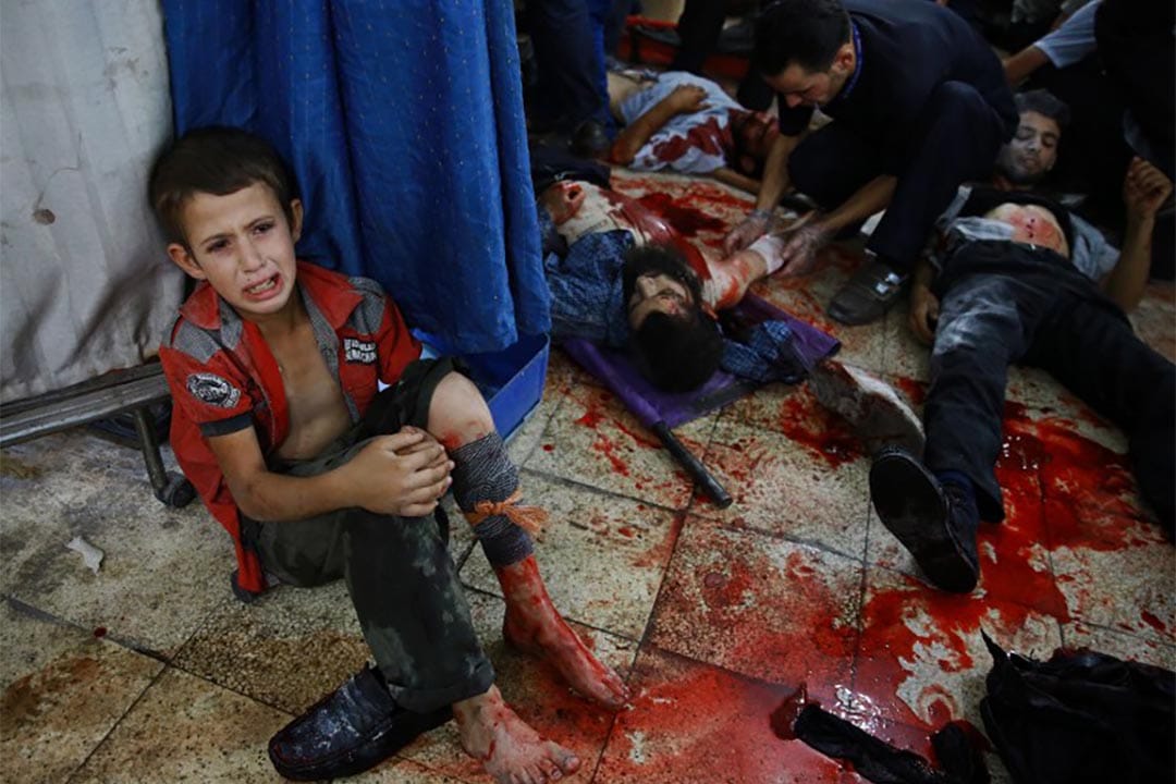 2015年8月12日，一個受傷的敍利亞男孩坐在地上接受治療。