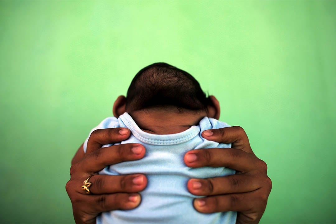 2016年2月11日，巴西，一个母亲抱起患有小头症的孩子。 