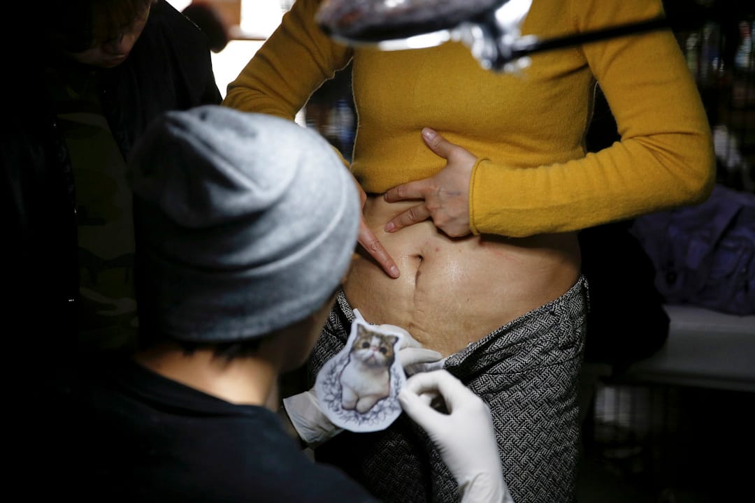 纹身师正准备为 Wang Jing 的疤痕纹上图案。