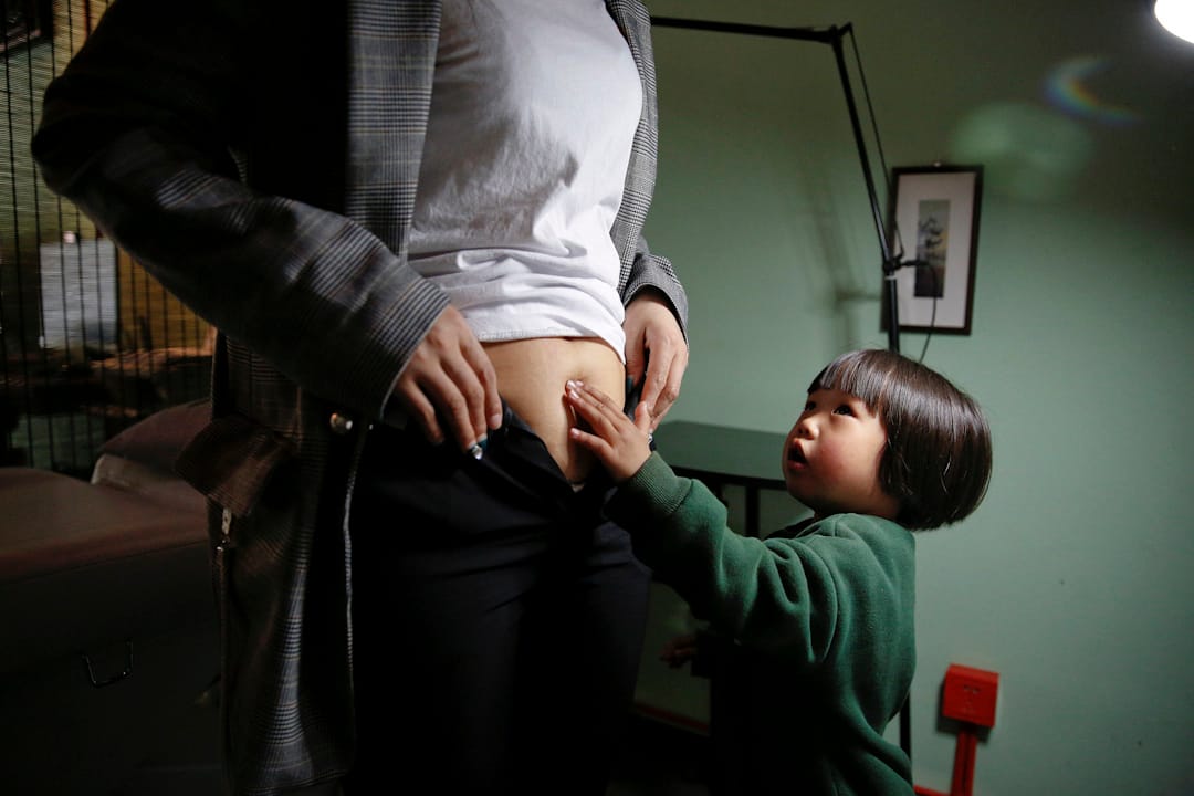 Grace的3岁大女儿摸着妈妈肚皮上的疤痕。